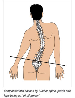 Hip alignment issues